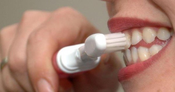 Diş beyazlatma için doğal olarak 10 teknik