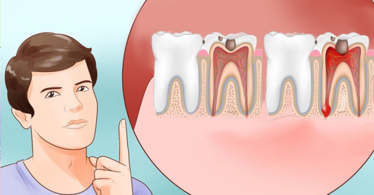 Diş ağrısı nasıl geçer